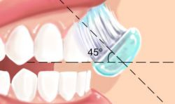 Pour le brossage des faces externes et internes des dents, la brosse doit être inclinée à 45° sur la jonction entre la gencive et la dent. Un mouvement de "rouleau" sera réalisé 2 à 3 fois par dent pour éjecter la plaque dentaire.
