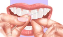 Pour parfaire l’hygiène buccale, brosser doucement la langue et les gencives afin de bien les nettoyer. Un fil dentaire peut également être passé régulièrement entre les dents, en prenant soin de ne pas abîmer la gencive.