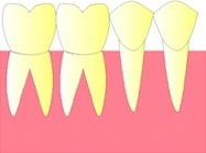 Les dents d'une même arcade sont côte à côte et restent "bien rangées".